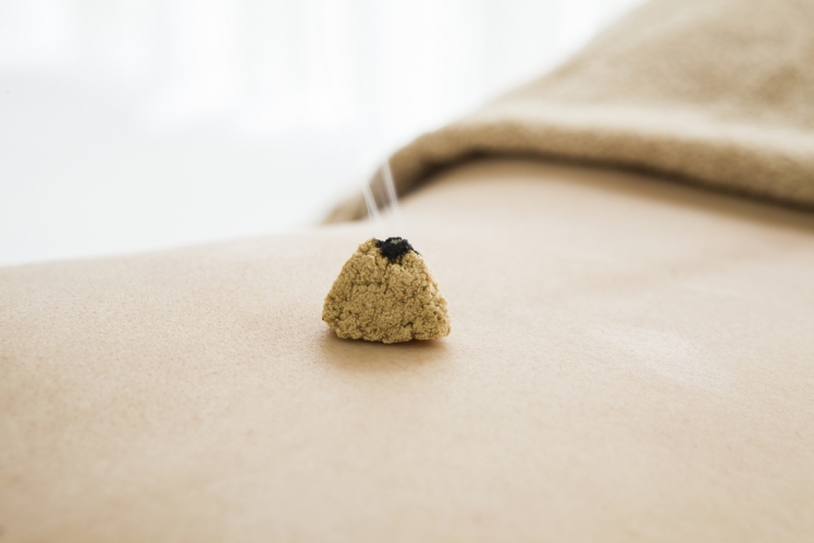 訪問マッサージの鍼灸